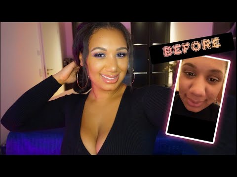 SO.. I got Plastic Surgery in Turkey //RHINOPLASTY AND BREAST LIFT // MELLOBEAUTI