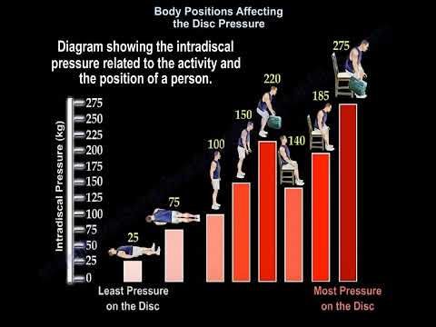 Posiciones corporales que afectan a la presión discal