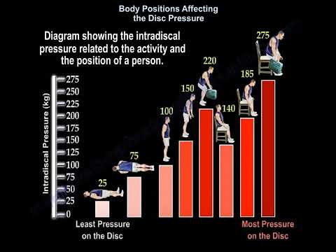 Pozycje ciała a ucisk na dyski międzykręgowe - dr Nabil Ebraheim