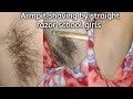 Frist Time Heavy Hair Armpit Shaving By Straight Razor School Girls Shaving Underarms Shaving