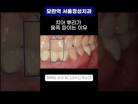 땡큐성형외과 Clips