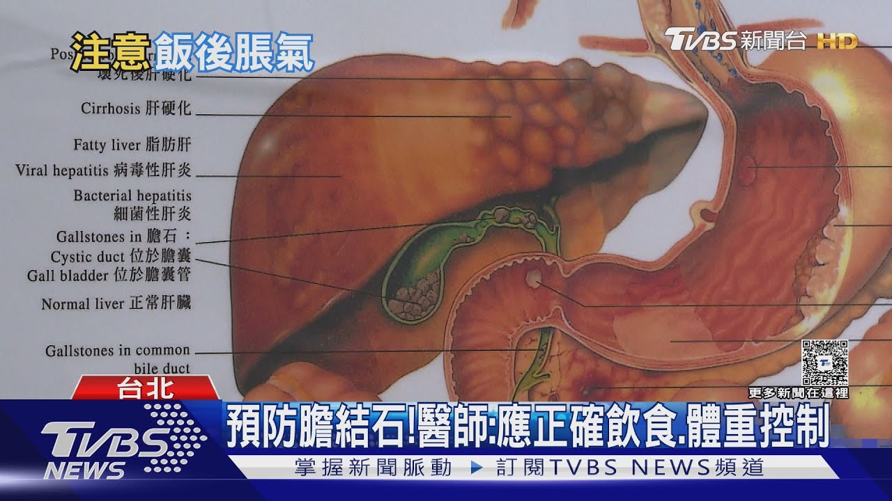 吃太油太甜易腹脹?醫揭「右上腹痛」 恐是膽結石警訊!