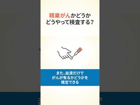精巣がんについて詳しく解説