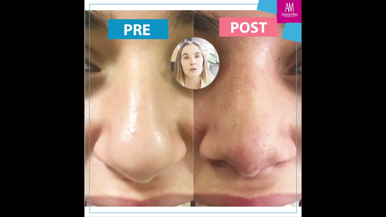 Alexandra Mora Hernandez-144