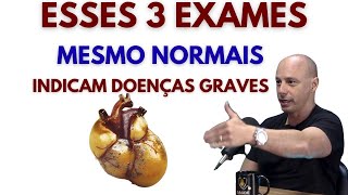 Seu MÉDICO Avalia seu Exame ERRADO || Dr. Moacir Rosa