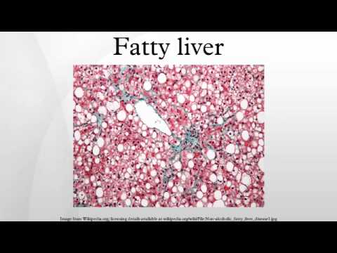 脂肪肝 (Fatty liver)