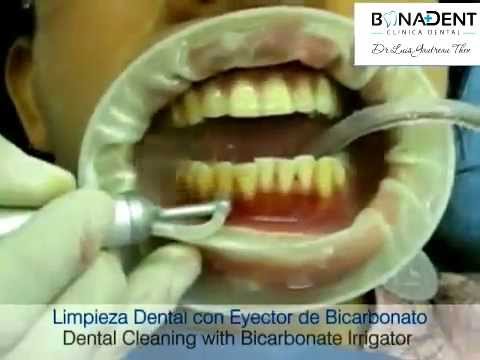 Dentista Madrid | Higiene Dental Reviews