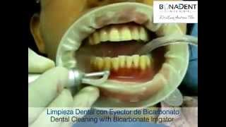 Dentista Madrid Higiene Dental Reviews - Clínica Dental Bonadent