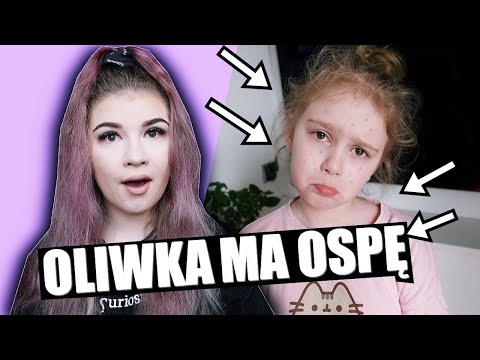 OLIWIA ZACHOROWAŁA NA OSPĘ 😱 ROBIMY JEJ NIESPODZIANKĘ NA POCIESZENIE 💜 VLOG DARLIVKA