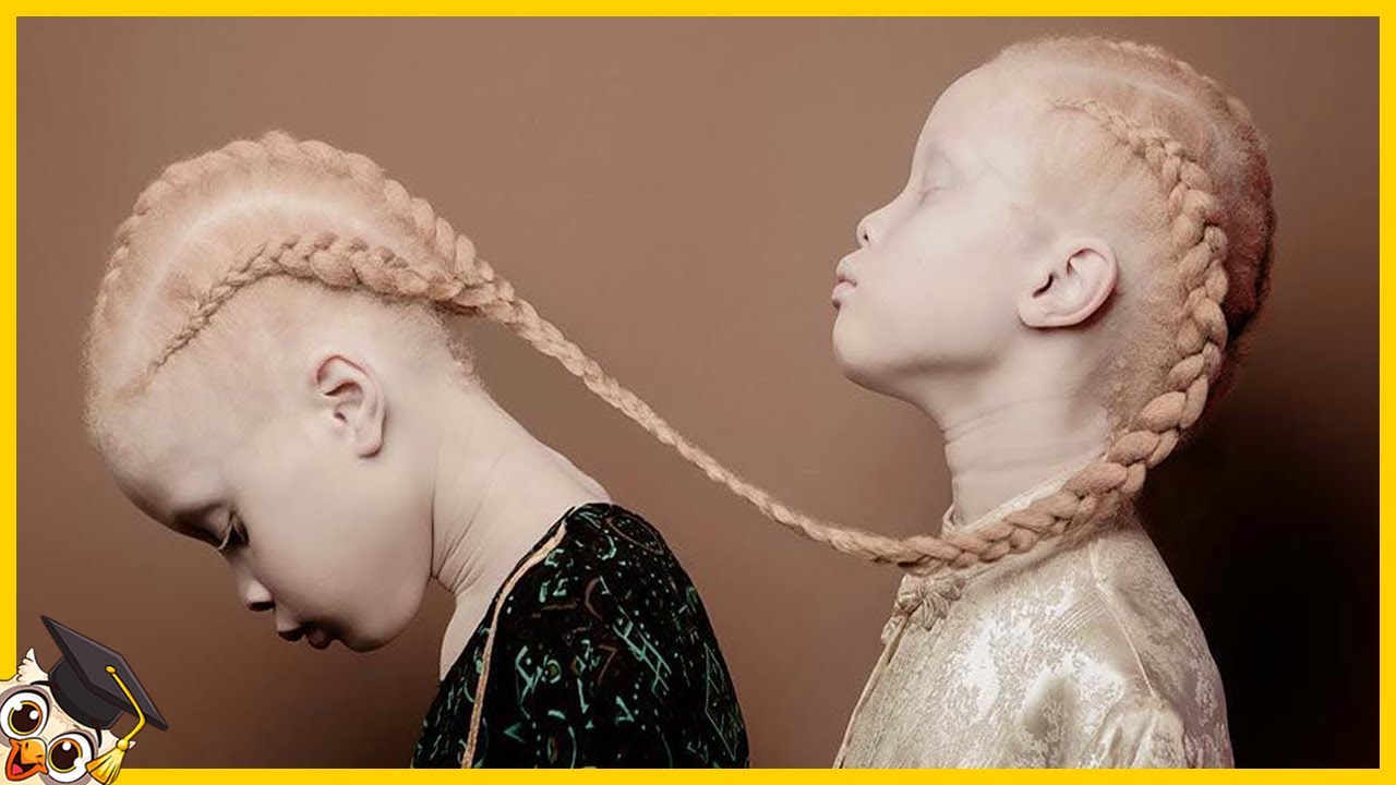 10 Crianças que nascem apenas uma vez em mil anos