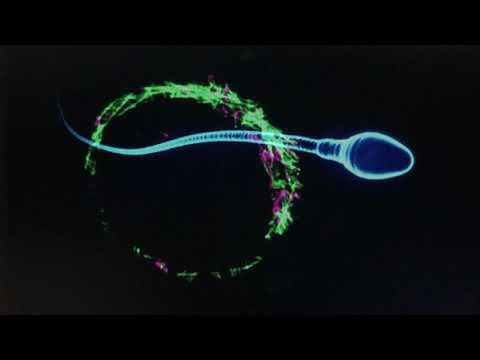 MONTiMi - Trois.10 Apnée nocturne