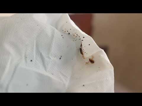 Corners of Bed Sheets Full of Bed Bugs in...