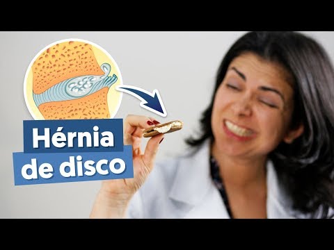 Hérnia de disco: Aqui está tudo que você precisa saber!