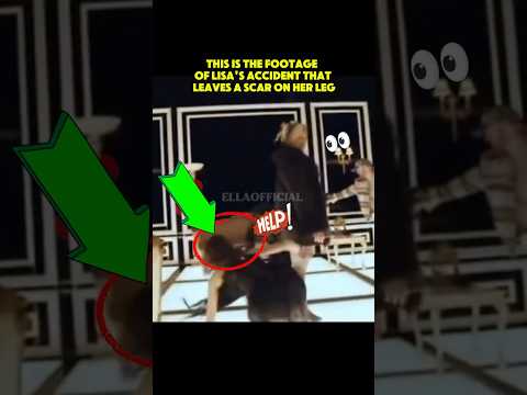 LISA GOT INJURED ON HER WAY TO SEE DOJA CAT AND RAYE 🥹😱 #lisamanoban #bornagain #lisa