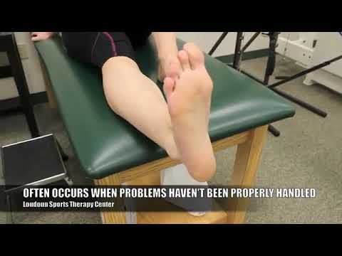 How Old Injuries Cast Lead to Plantar Fasciitis