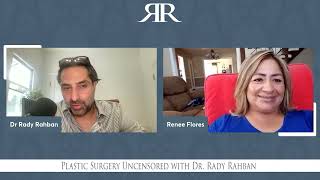 131 - Thigh Lifts with Renee | Plastic Surgery Uncensored