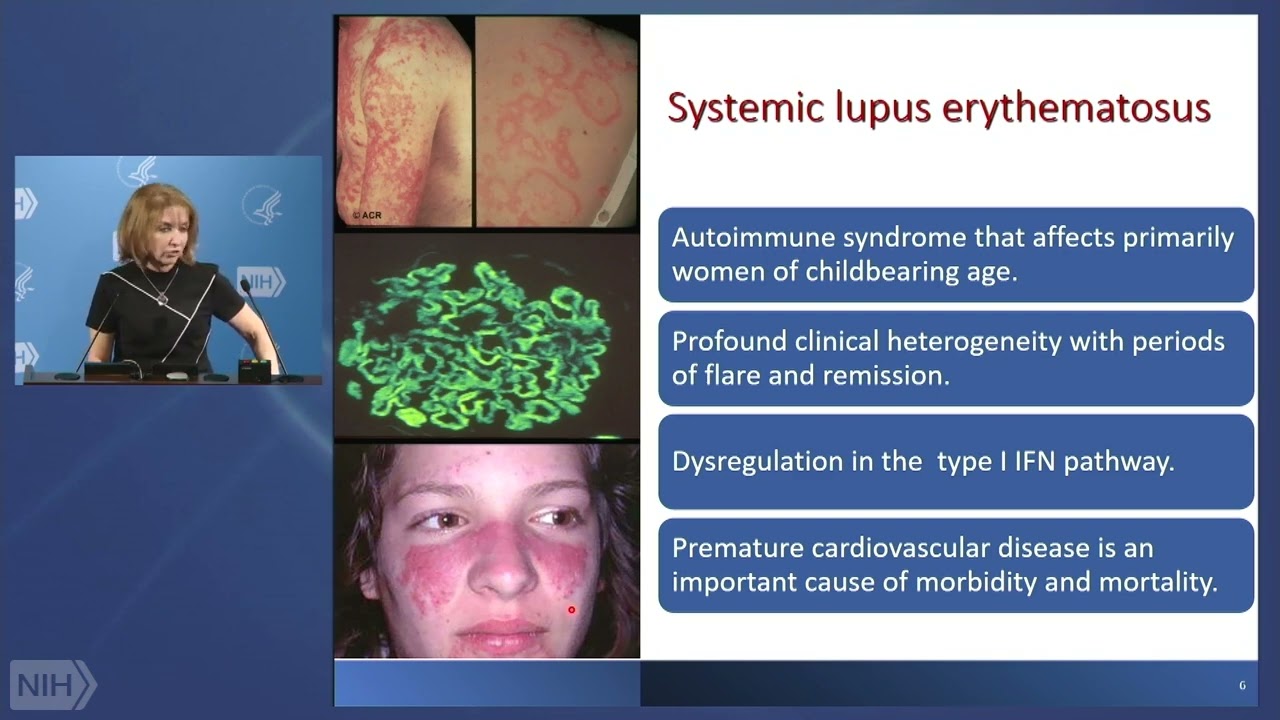 Unraveling Cardiovascular Disease in Autoimmune Disorders