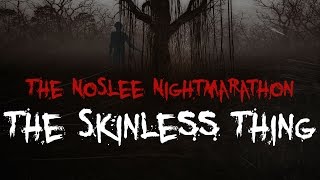 "The Skinless Thing" by  Sierraphernelia | The NoSleep Nightmarathon
