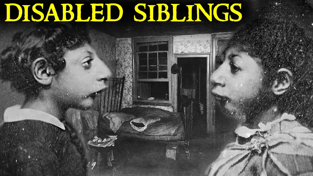 The Shocking Case of the Disabled “Aztec Children”