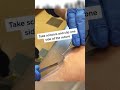 Suture Removal Instructional Video