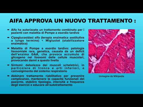 Una buona notizia per chi soffre di malattia di pompe