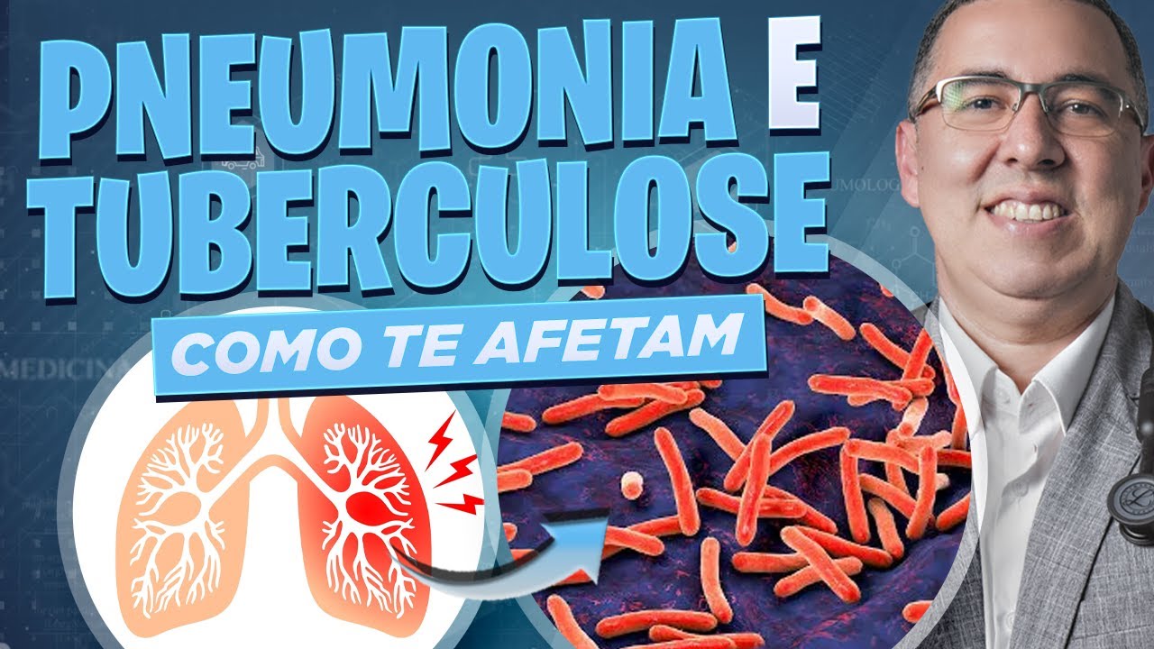 É TUBERCULOSE ou PNEUMONIA? Médico PNEUMOLOGISTA explica as diferenças e quais CUIDADOS tomar