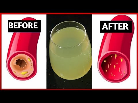 Only a Glass of This Juice will Remove Clogged Arteries, Plaque And Control Blood Pressure