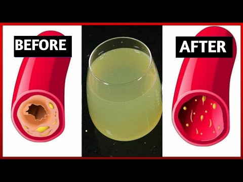 Only a Glass of This Juice will Remove Clogged Arteries, Plaque And Control Blood Pressure