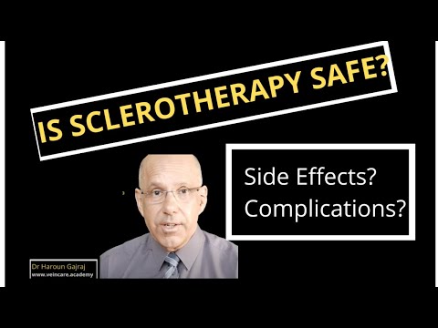 Is Sclerotherapy Safe? | Side Effects and Complications of Sclerotherapy