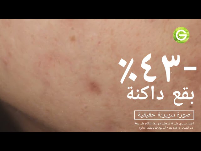 سيروم فيتامين سي للتفتيح السريع من غارنييه , 15 مل