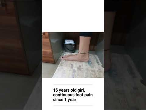 Surgical Approach to accessory navicular bone with associated flat foot deformity