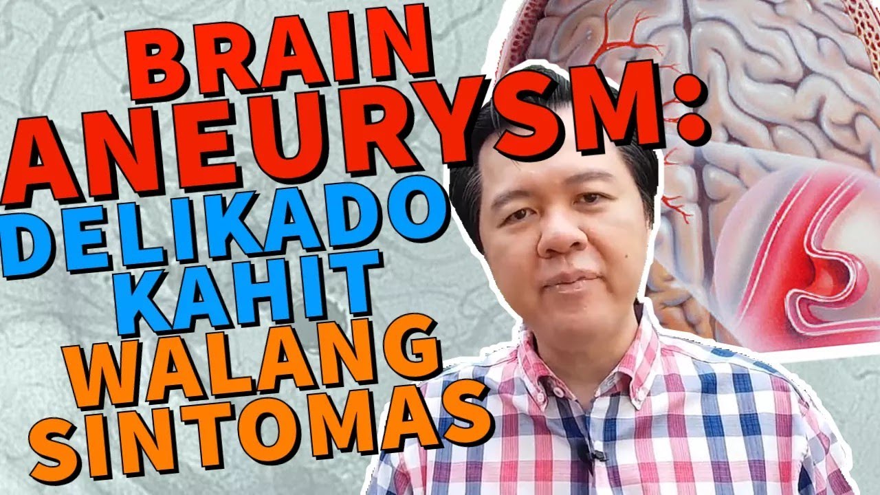 Brain Aneurysm: Nakamamatay kahit Walang Sintomas - Payo ni Doc Willie Ong #176