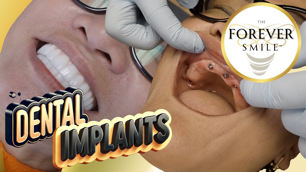 Effortless Smile on Your Mind? Watch the Magic Behind The Transformation!