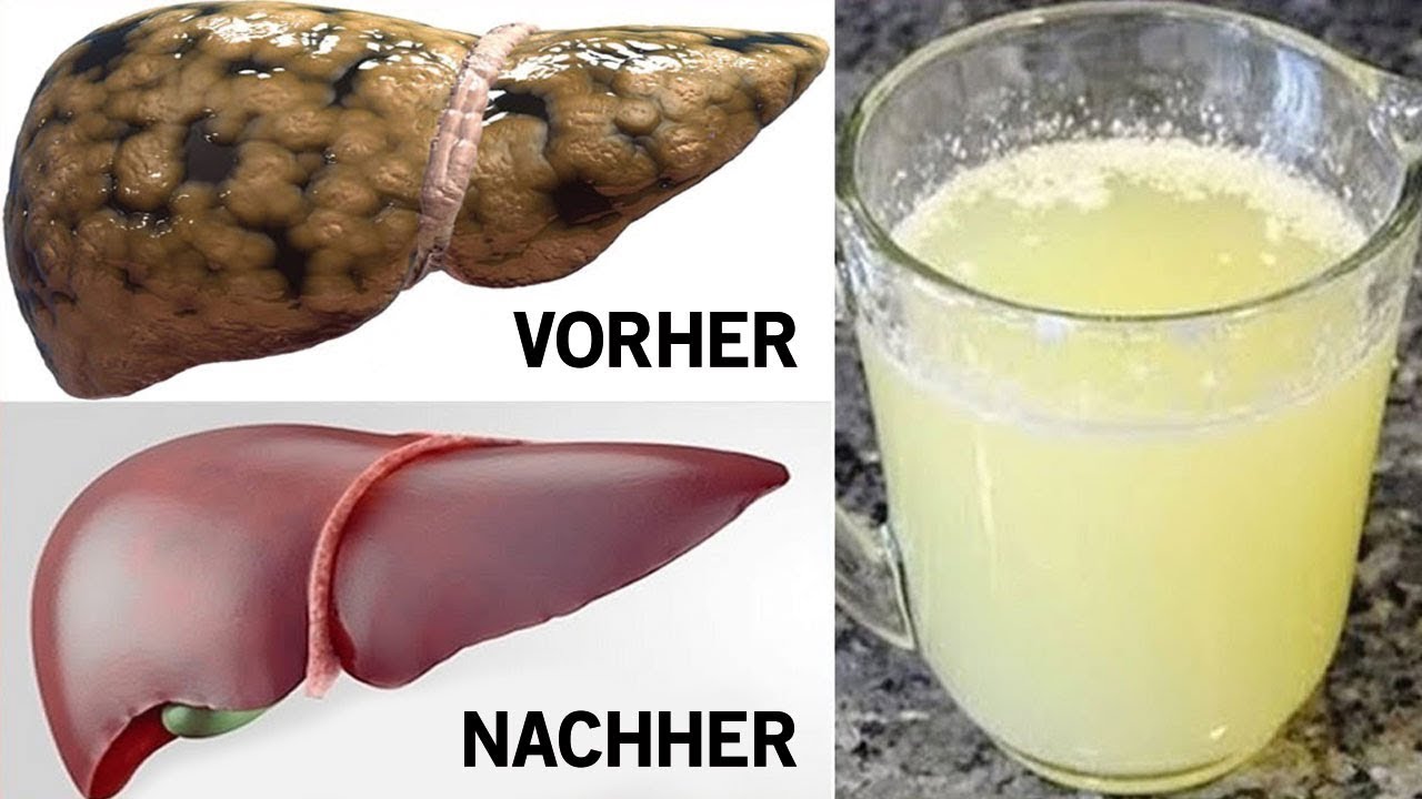 Trink eines dieser drei Getränke, um deine Leber zu entgiften!