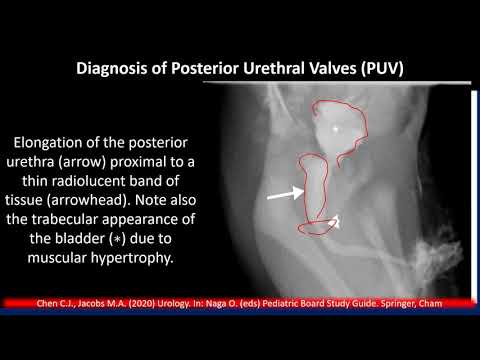Cartilajul a ieșit pe penis - Dr. PALEA OVIDIU NICOLAE | Pune o intrebare medicului | Provita