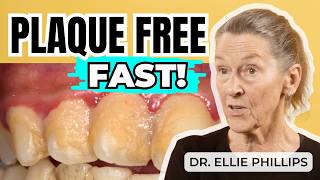 Get Rid of Plaque in 3 Months