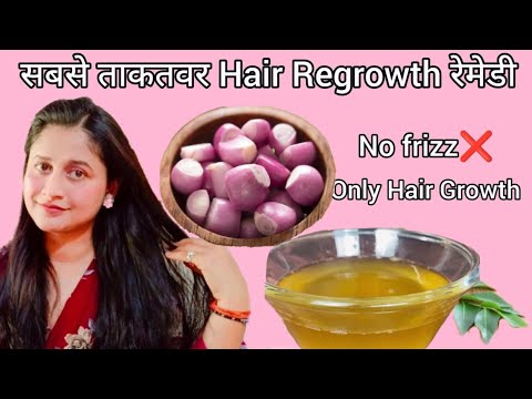 Summer Hair Oiling To*Reduces Sweat , Hairfall & Boosts Growth* इन गर्मियां झड़ेंगे नहीं उगेंगे बाल|