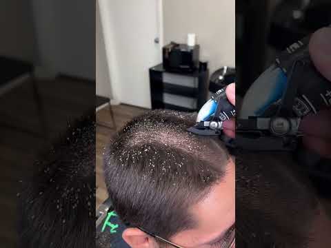 BARBER CUTS OFF LICE!!!! MUST WATCH