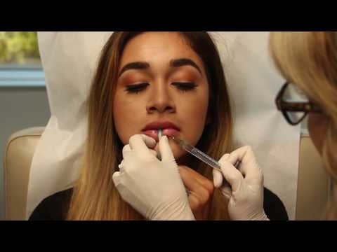 Double Lobed Lower Lip