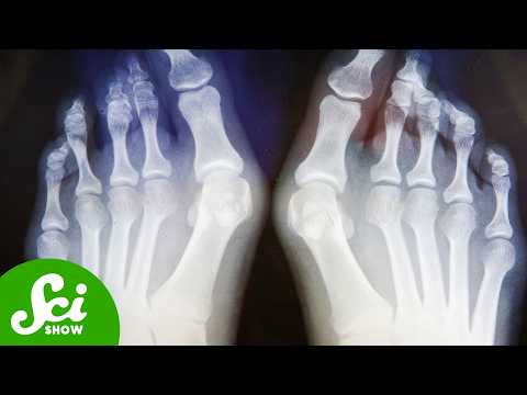 We Still Don’t Know Why We Walk on Two Legs