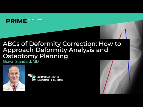 Deformity Correction: How to Approach Deformity Analysis & Osteotomy Planning - Shawn Standard, MD