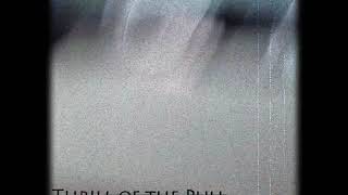 Thrill of the Pull - Everlasting Dream