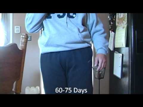 Teen Weight Gain Experiment