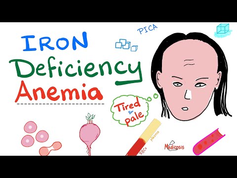 Iron Deficiency Anemia - All you need to know - Causes, Symptoms, Diagnosis, Treatment