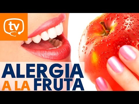 La alergia a frutas ¡todo lo que debes saber!
