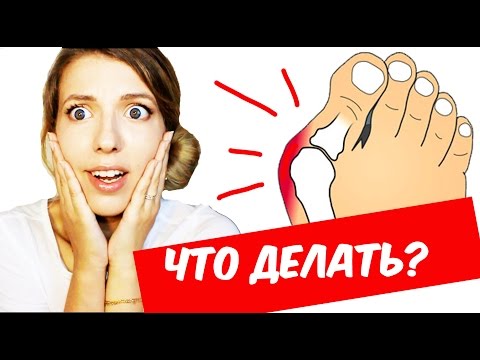 Когда занимаюсь спортом болит поясница Высокая температура боль в левой части со спины