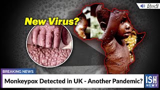Monkeypox Detected in UK - Another Pandemic?