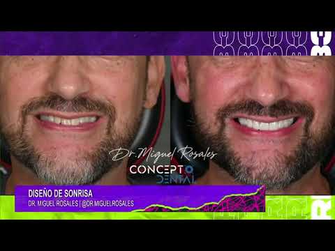 Miguel Rosales-40