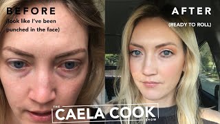How to Cover Up Dark Eye Under Circles, Dark Troughs and Sunken in Eyes/ Conceal & Color Correct