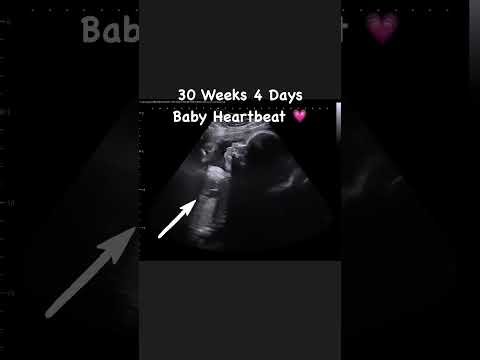 30 Weeks 4 Days Heartbeat #jerbearimaging #heartbeat #sono #peaceofmind